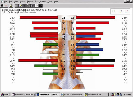 Neurological Scan